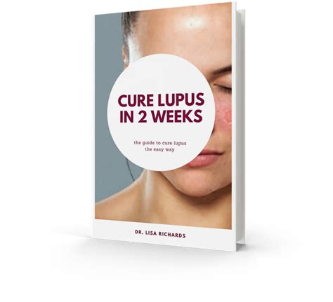 lupus cure