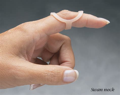 Oval-8 Finger Splint Kit ON SALE