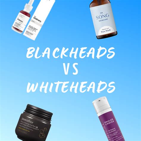 Whiteheads vs Blackheads - Picky | The K-Beauty Hot Place