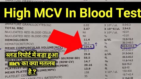 Mcv Blood Test In hindi || Mcv Test || Mcv High In Blood Test || Mcv Blood Test Results - YouTube