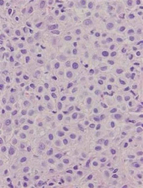 Cytology vs. Histopathology | Clarendon Animal Care