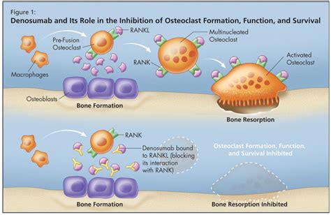 Bone Biology and the Role of RANK/RANKL/OPG Pathway | HealthPlexus.net