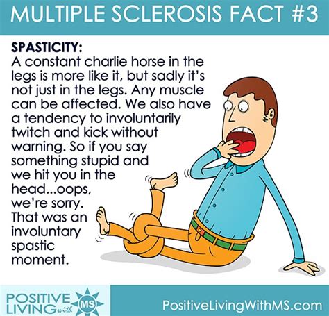 Multiple Sclerosis Spasticity | Multiple experienceS