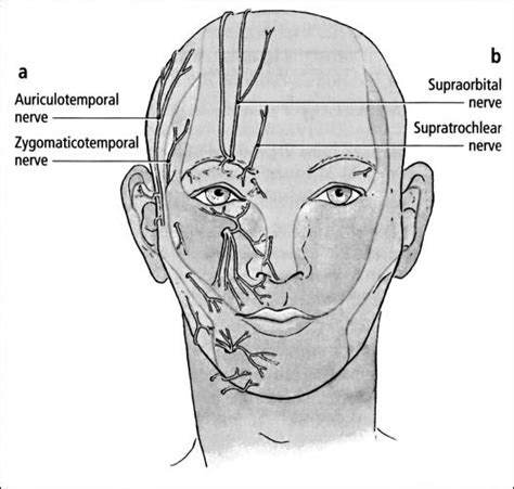 Swimmer's headache, or supraorbital neuralgia. - Abstract - Europe PMC