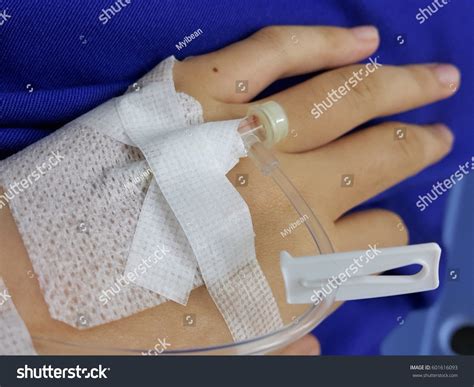 Woman Hand Iv Drip Needle Stock Photo 601616093 - Shutterstock