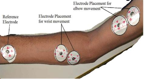 Electromyography(EMG) sensor controlled assistive orthotic robotic arm ...