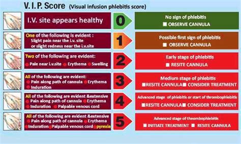 Iv Infiltration Scale