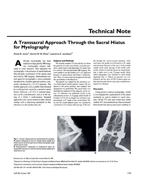 (PDF) A transsacral approach through the sacral hiatus for myelography