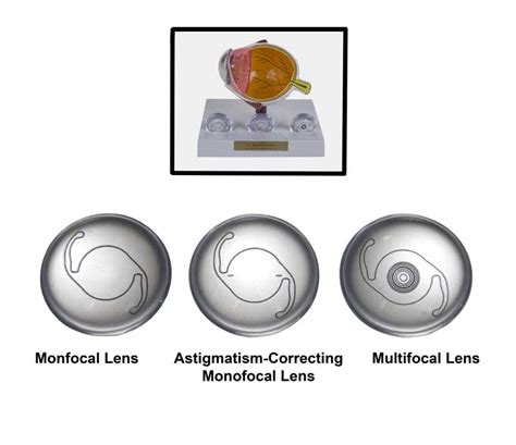 IOL-lenses