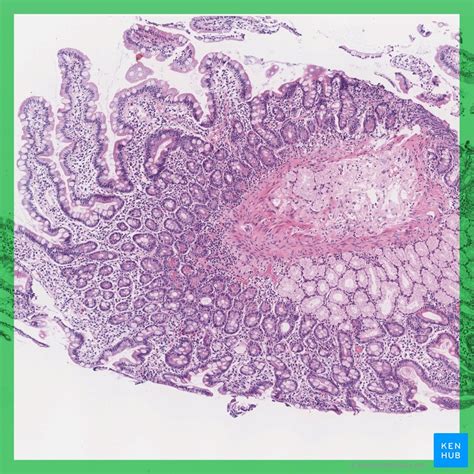 Duodenum Jejunum Ileum Histology