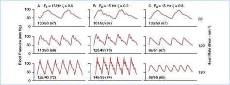 Monitoring the Cardiac Surgical Patient | Anesthesia Key