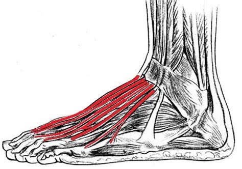 Top 11 Tendonitis On Top Of Foot - Interconex