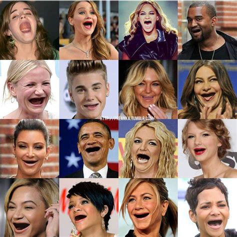 Celebrities without teeth • Stouffville SMILES Dentistry & Orthodontics