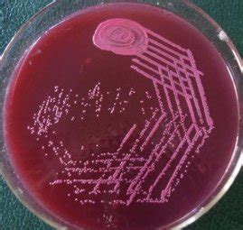 Macconkey Agar Lactose Fermentation