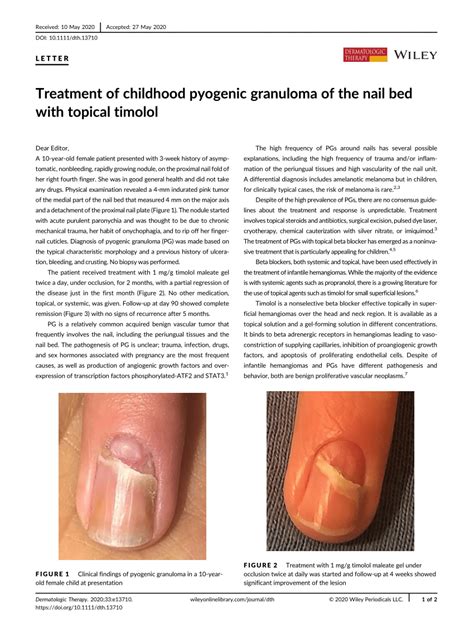 Treatment of childhood pyogenic granuloma of the nail bed with topical timolol | Request PDF