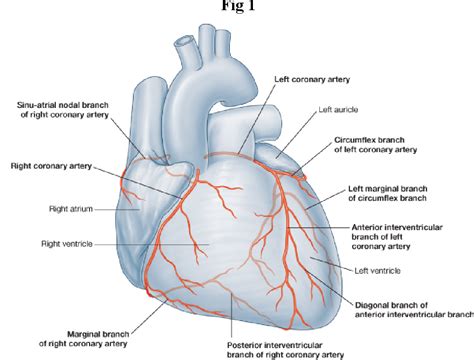 Figure 1 from Comparative Study of anterior and inferior wall ...