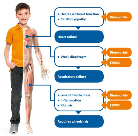 Muscular Dystrophy - Symptoms, Causes & 02 Risk Factors