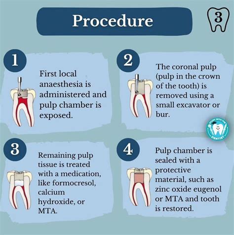 Pulpotomy - Procedure - MEDizzy