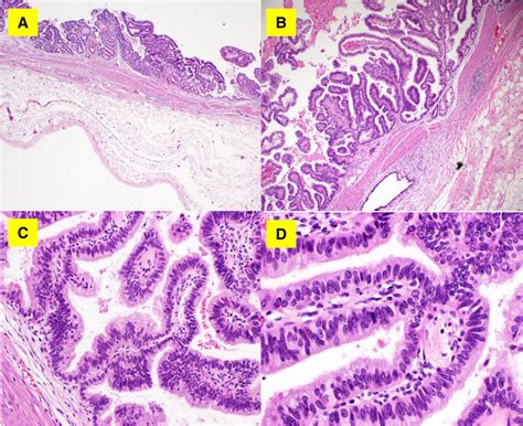 Common Bile Duct Histology