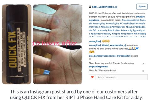 RIPT Hand Care Kit: CrossFit, Gymnastics Hand Care Treatment – RIPT Skin Systems