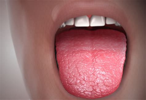 Dry mouth during pregnancy | General center | SteadyHealth.com