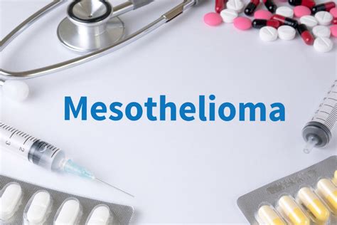 Mesothelioma Treatment Options to Consider - MD Monthly | Today's ...