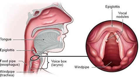 Vocal nodules | informedhealth.org