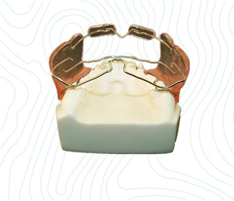 Frankel Orthodontic Appliance | Types of Frankel Functional Appliance