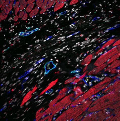 Cardiac Tissue Regeneration — The Monaghan Lab