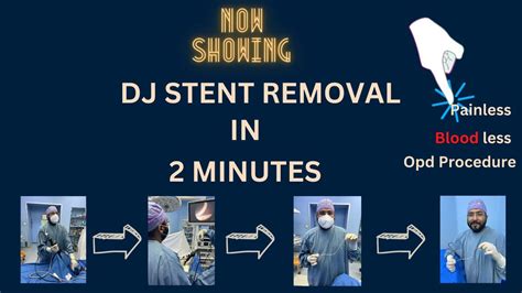 DJ STENT REMOVAL in 2 mins - LIVE Surgery, Office / OPD Procedure - YouTube