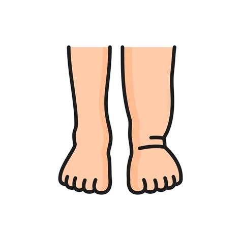 Lymphedema, swelling legs and edema color icon 22032886 Vector Art at Vecteezy