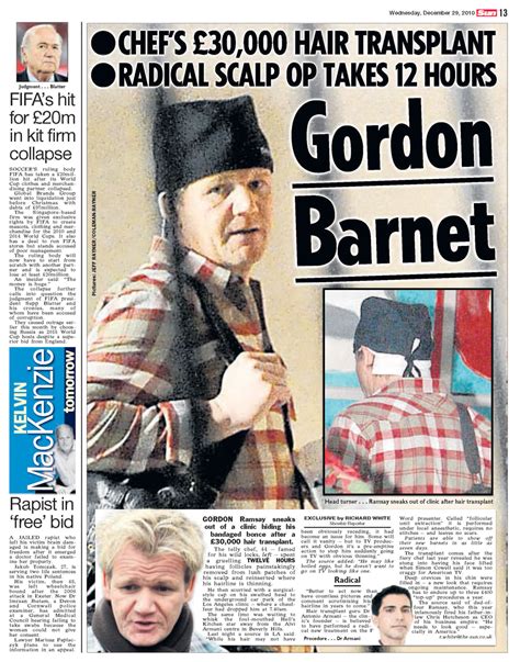 Gordon Ramsay spotted after undergoing hair transplant | Coleman-Rayner