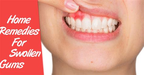 Home Remedies Swollen Gums - the United States | about.me