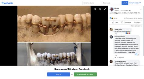 Fact Check: This Photo Is NOT Ancient Egyptian Dentistry -- This Dental ...