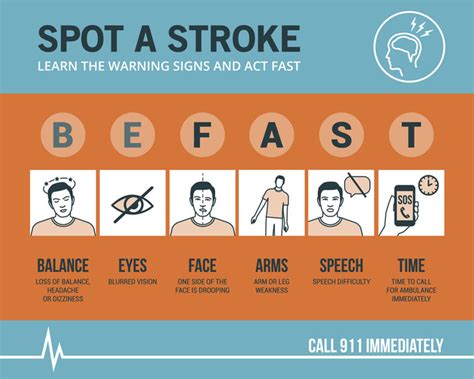 How to recognize a ministroke or stroke — and what to do - Harvard Health