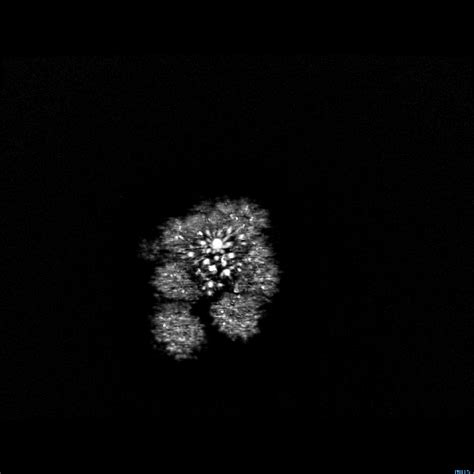 The MRI scan of a Broccoli looks like a tree or a firework! – Tree ...