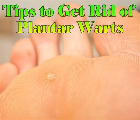 Stuttering Home Remedies: Seed Wart Removal Home Remedies