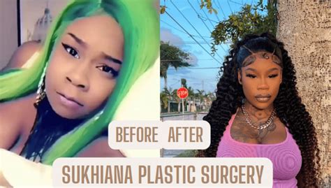 Sassy Rapper Sukihana Plastic Surgery Revealed with 100% Facts!