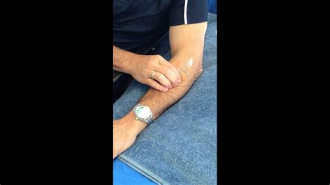 Tennis elbow treatment-self massage - YouTube