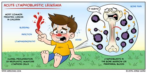 Acute Lymphoblastic Leukemia | Pediatric nursing, Nursing mnemonics ...