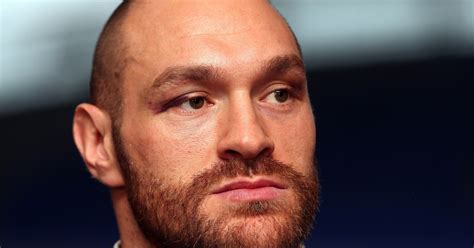 Tyson Fury Posts Deeply Open Letter About His Physical & Mental Health