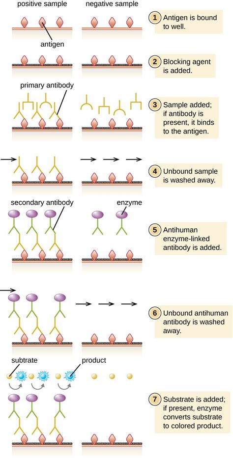 20.4: Enzyme Immunoassays (EIA) and Enzyme-Linked Immunosorbent Assays ...