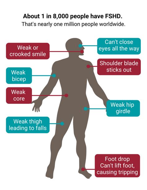 Muscular Dystrophy Symptoms