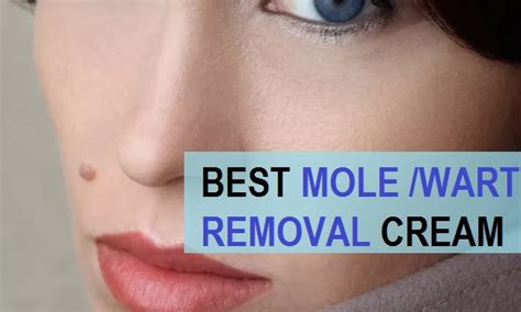 Top 9 Best Mole Removal Creams in India (2021) | Mole removal cream ...