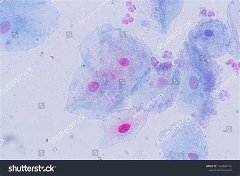 Epithelial Cells Under Microscope Labeled