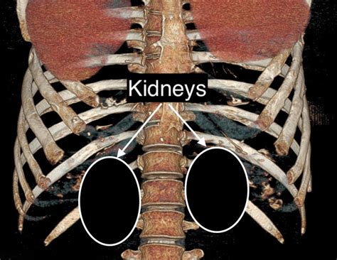 Rib Removal in Waist Narrowing Surgery and The Misconception of Loss of Organ Protection ...