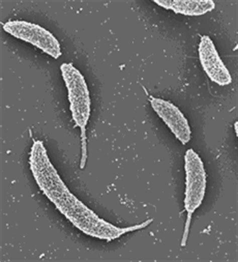 Stalked Bacteria – Caulobacter crescentus | Medical Laboratories