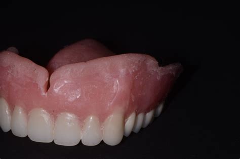 A Primer on Soft Denture Liners - Spear Education