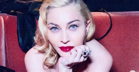 Did Madonna Get Cosmetic Surgery? The Pop Singer Looks Unrecognizable