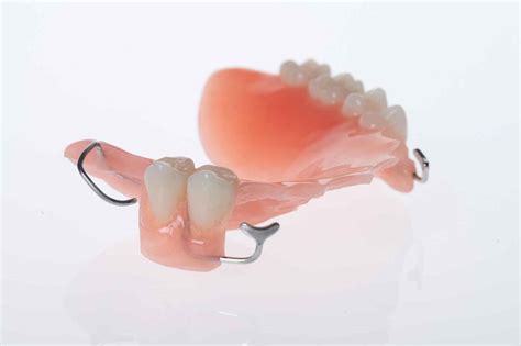 Acrylic Partial Dentures from $700 Cost & Prices Gold Coast